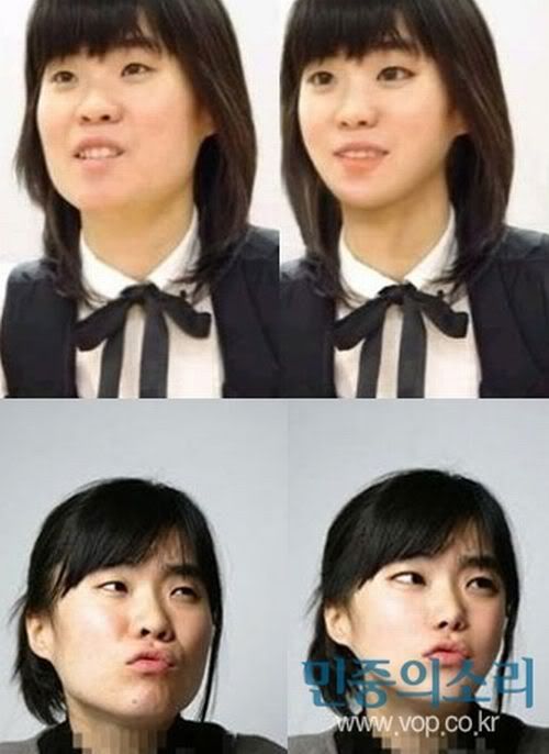 Comedienne Park Jisun gets a new face · K-POPPED!